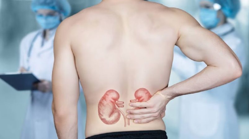 Ayudan con los cálculos en los riñones