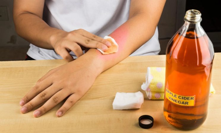 El vinagre de manzana tiene usos medicinales