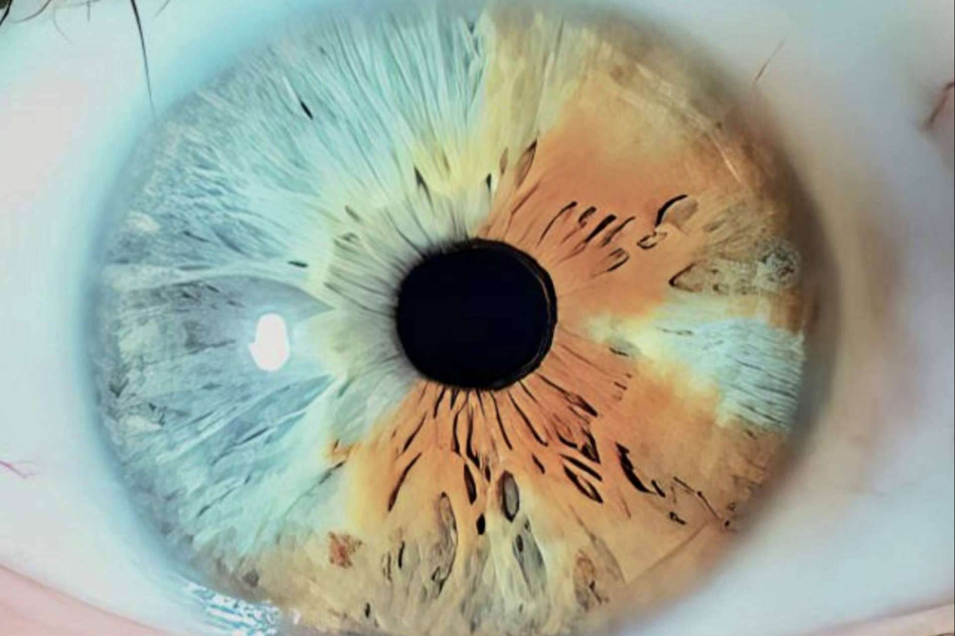 La presentación del gran libro Atlas sobre el cambio de color de ojos con láser, por Eyecos