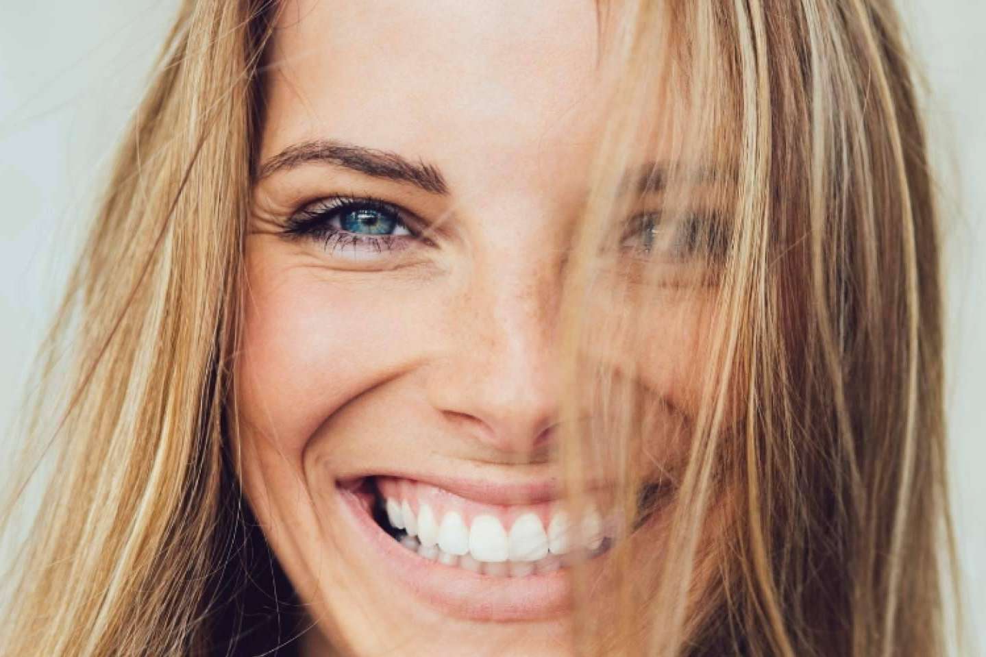 Tratamiento para la sonrisa gingival en la Clínica Dental Ruiz de Gopegui
