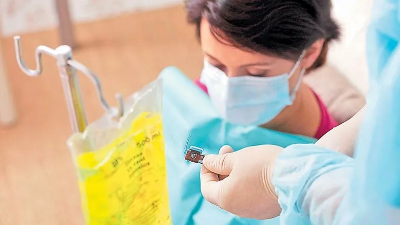 El impacto de la quimioterapia en el cuerpo humano 4 Merca2.es Quién debe recibir quimioterapia