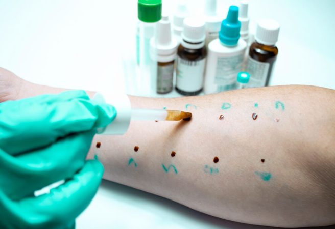 Prueba de alérgenos