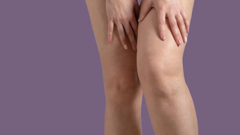 Retención de líquidos, ¿cuándo acudir al médico? 31 Merca2.es Causas de la retención de líquidos