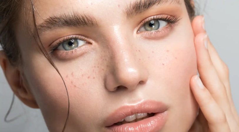 Estos son los bulos más frecuentes sobre el ácido hialurónico, los desmontamos 30 Merca2.es Modifica la expresión del rostro