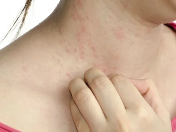 Esto es lo que le pasa a tu cuerpo cuando llevas ropa demasiado ajustada 8 Merca2.es piel Merca2.es