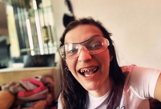 Dientes de Camilo Blanes