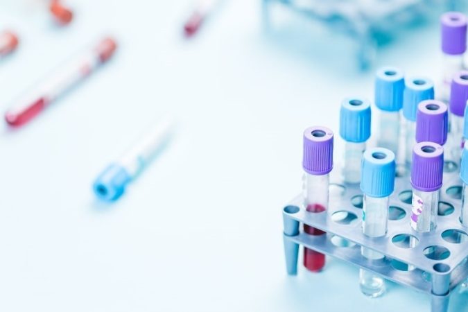 Las nuevas terapias con células T para diabetes y EII de AstraZeneca y Quell 1 Merca2.es EuropaPress 5275690 laboratorio clinico Merca2.es