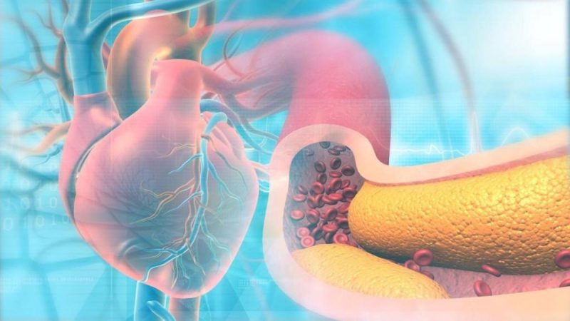 alimentos que disparan el colesterol 2 Merca2.es