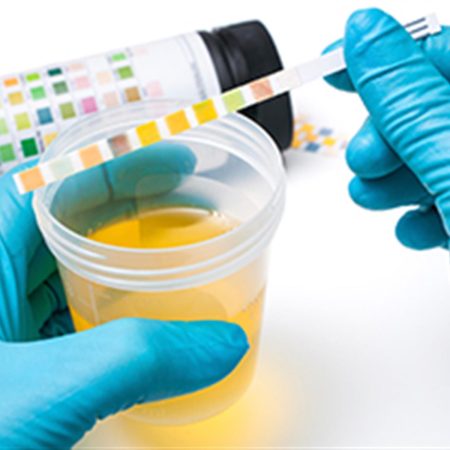 Un inconveniente de salud que es más común de lo que piensas