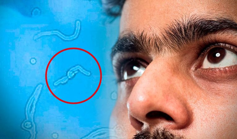 Un procedimiento quirúrgico que conlleva ciertos riesgos