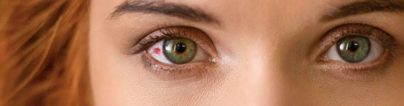 No necesariamente se trata de algo grave