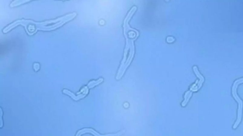 ¿Cuáles son los tratamientos disponibles?