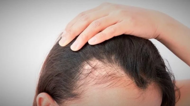 Se necesita una evaluación completa