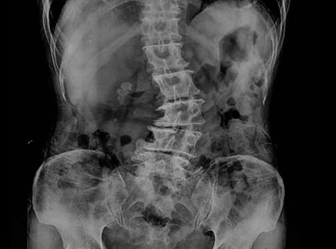 radiología digital dinámica radiología digital dinámica