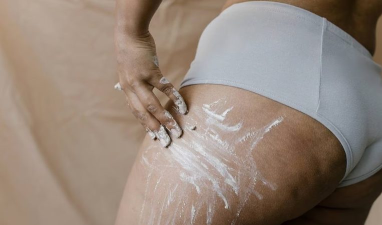 ¿Se puede eliminar la celulitis?