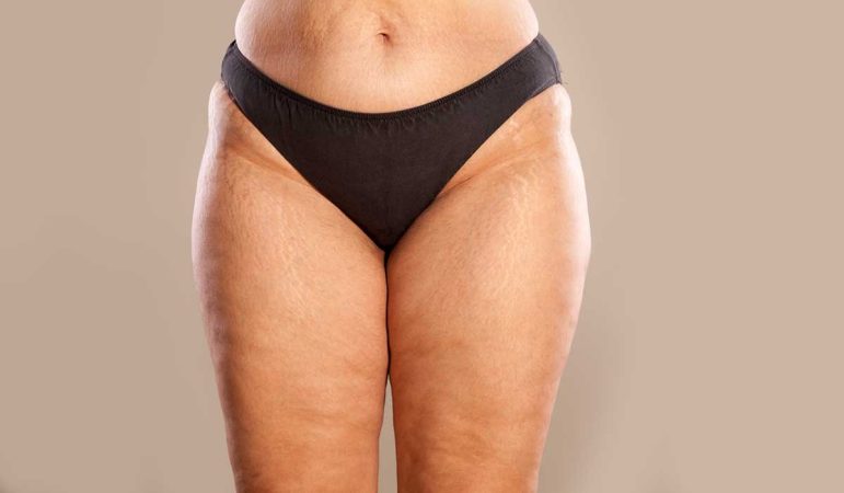 Debes depurar tu cuerpo