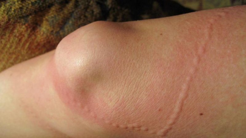 Estos son los animales y microorganismos que te pueden picar cuando te bañas en la playa 47 Merca2.es tencaculo Merca2.es