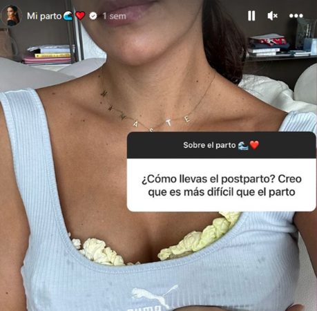 Cristina Pedroche con hojas de col en el pecho