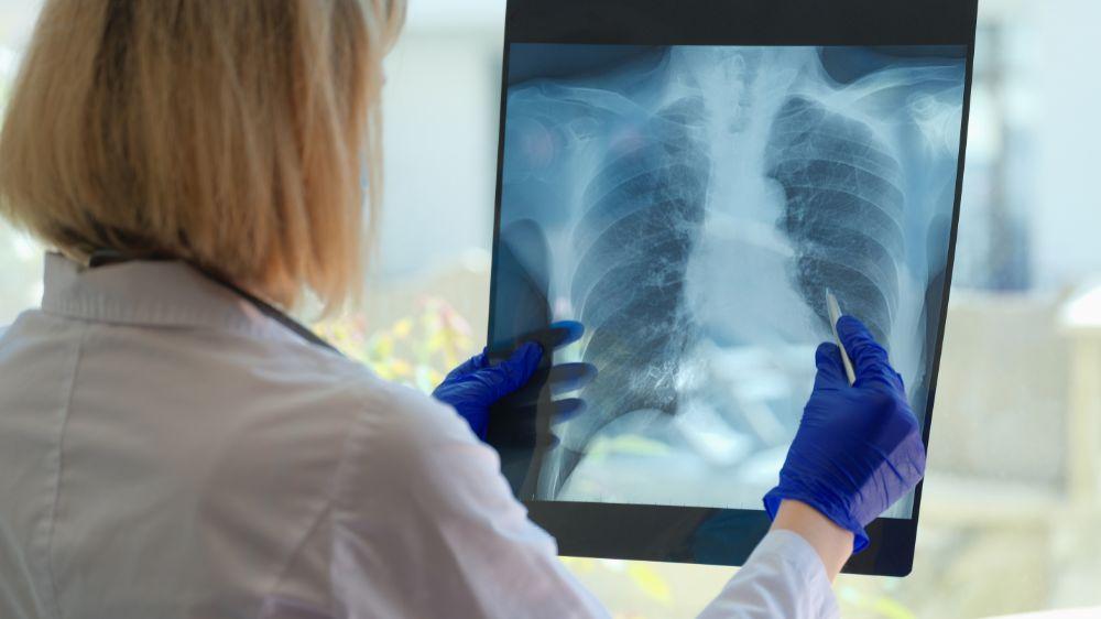 radiografia