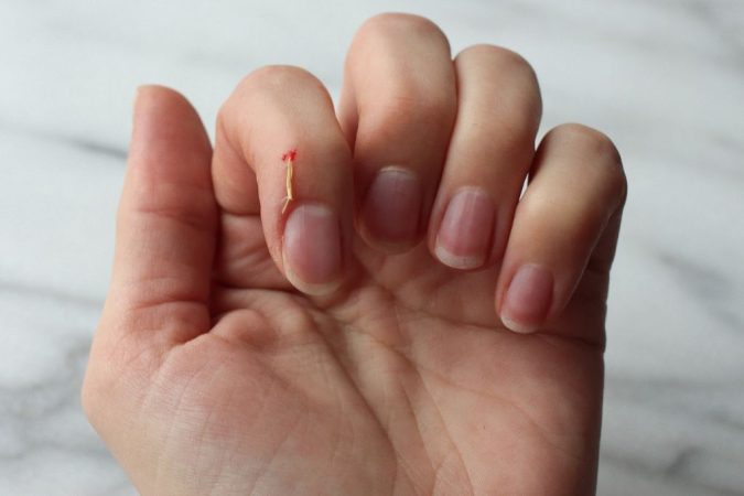 Depilación indolora, otro de los prácticos usos del hielo