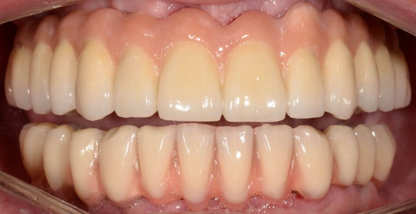 Es algo que nuestro cuerpo hace normalmente