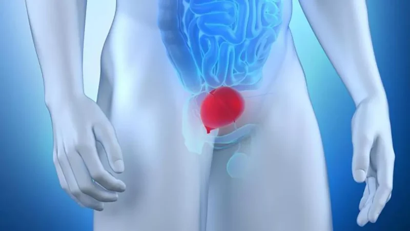 Ejercicios de Kegel para fortalecer el suelo pélvico masculino