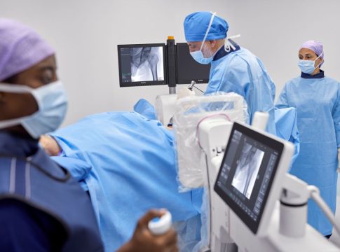 zenition-30-photo Philips Zenion