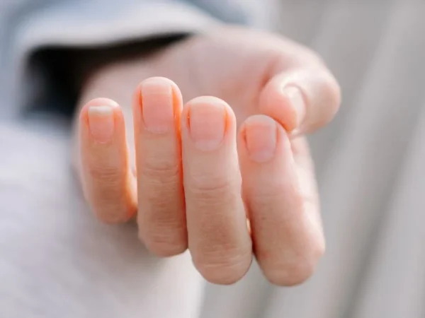 Es un asunto que va más allá de lo estético