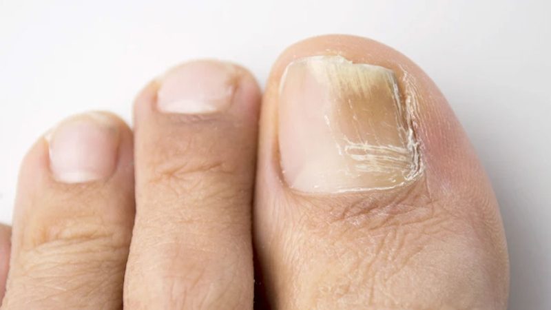 También pueden ser causadas por factores externos