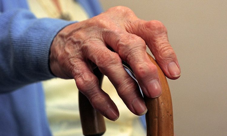 La artritis reumatoide: ¿qué es y cuáles son sus causas? 2 Merca2.es artritis 2 Merca2.es