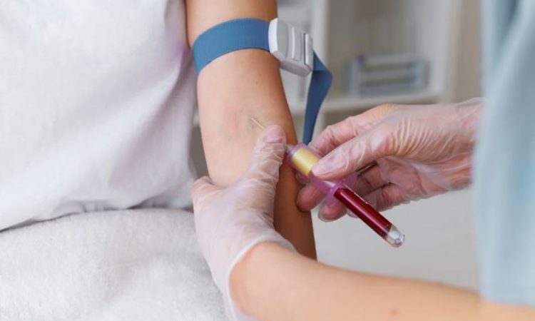 Explorando nuevos horizontes: un test de sangre revolucionario para detectar el Parkinson en sus primeras etapas