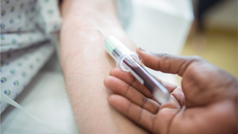 El Parkinson se puede diagnosticar de forma temprana