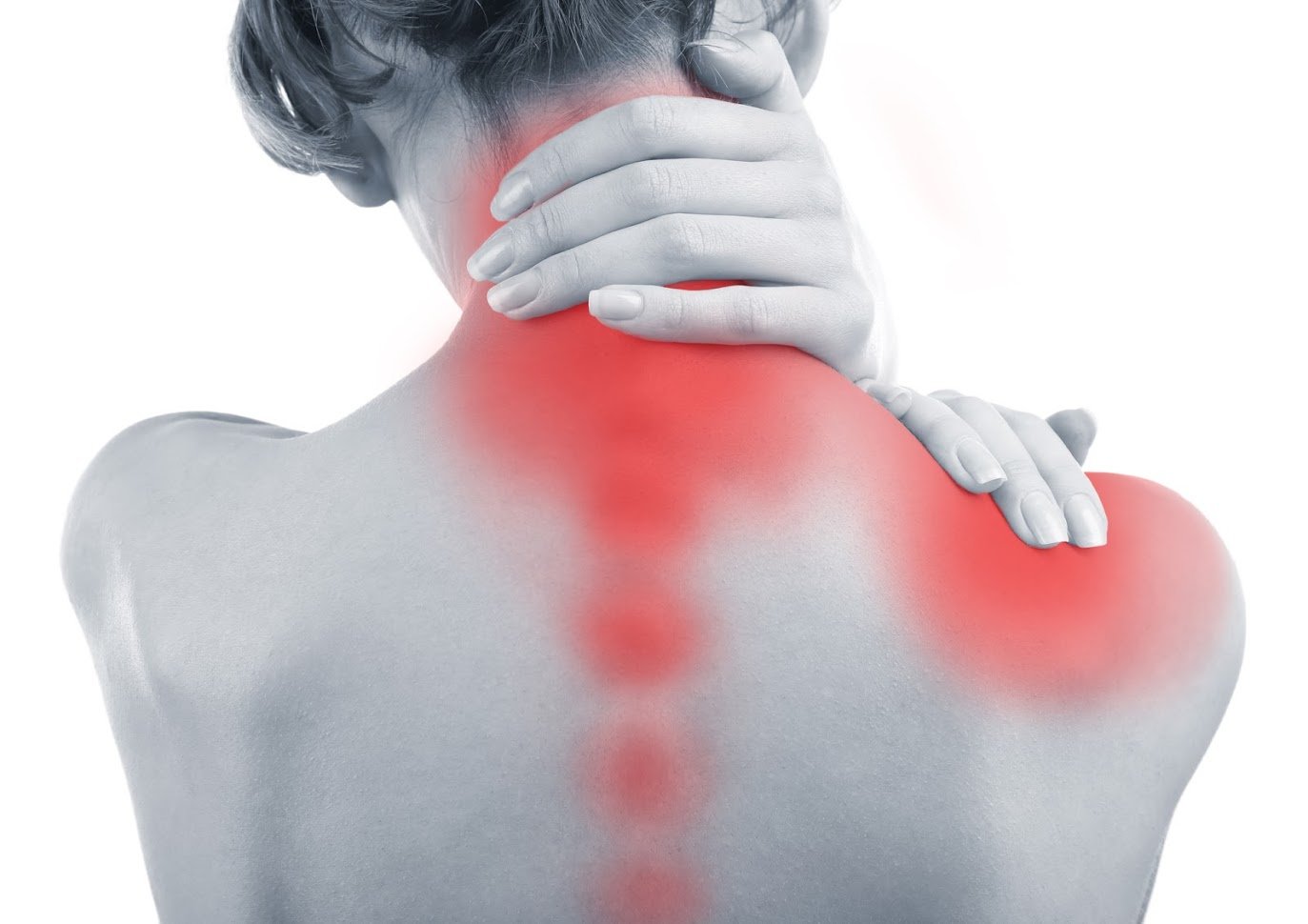 Fibromialgia Fibromialgia