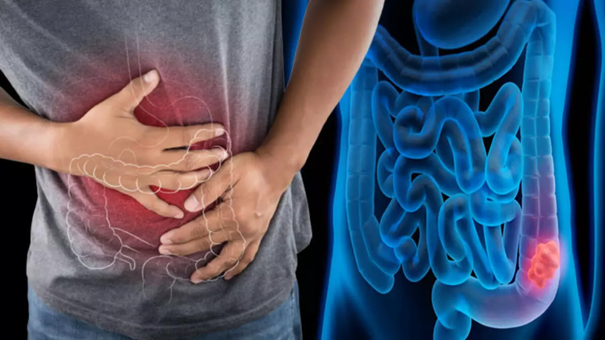 INVESTIGACIÓN Y AVANCES EN EL TRATAMIENTO 