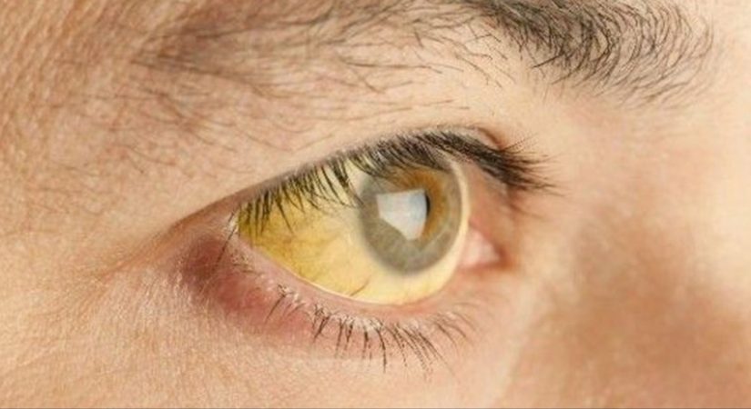 Por qué es importante vacunarse contra la hepatitis B 2 Merca2.es LA RESPONSABILIDAD COLECTIVA