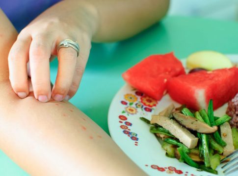 alergias alimentarias ¿Cómo saber si tengo alergia o una intolerancia alimentaria?