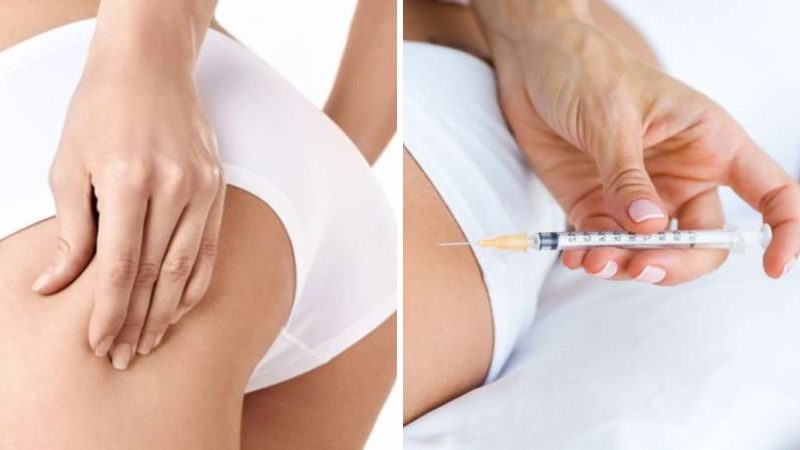 ¡Stop bananas! El retoque estético de Isabel Pantoja 1 Merca2.es Stop Banana jpg Merca2.es