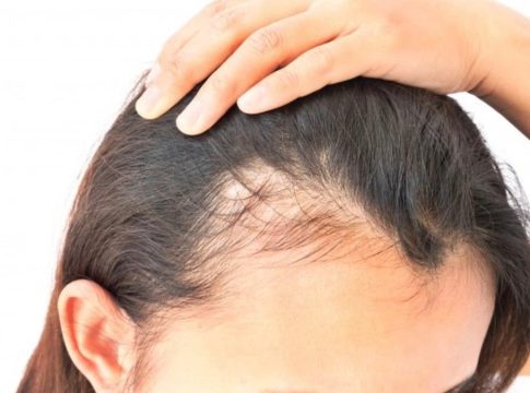 cabello Este es el secreto mejor guardado para detener la caída del cabello