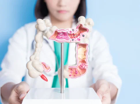 reducir-riesgo-cancer-dieta Cómo reducir el riesgo de cáncer con una dieta saludable y equilibrada