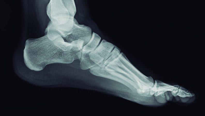 Jonathan, técnico de rayos, nos cuenta algunas de las más impactantes cosas que ha visto en sus radiografías ¡Vas a alucinar! 1 Merca2.es Radiografías que cuentan historias