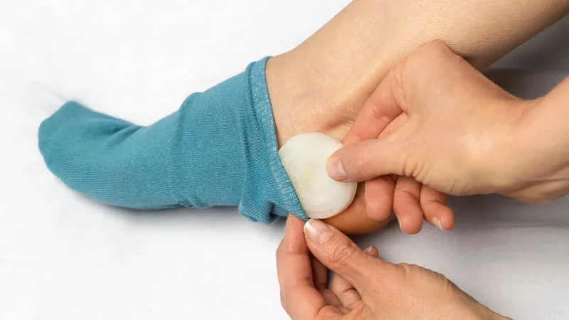 Increíble lo que puede hacer la cebolla en tus pies 1 Merca2.es ¿POR QUÉ CEBOLLAS EN LOS PIES?