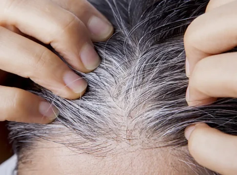 elimina-las-canas-sin-usar-quimicos Elimina las canas sin usar químicos con estas 3 plantas