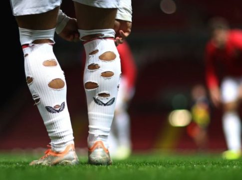 futbolistas calcetines agujereados La verdadera razón por la que los futbolistas agujerean sus calcetines
