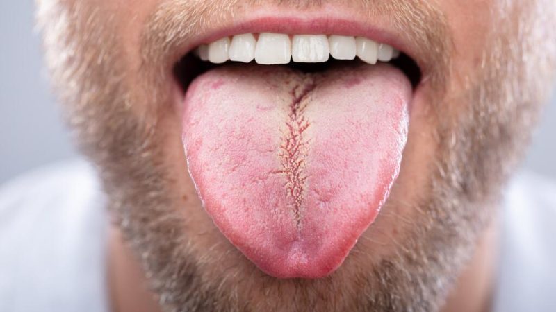 grieta medio Merca2.es