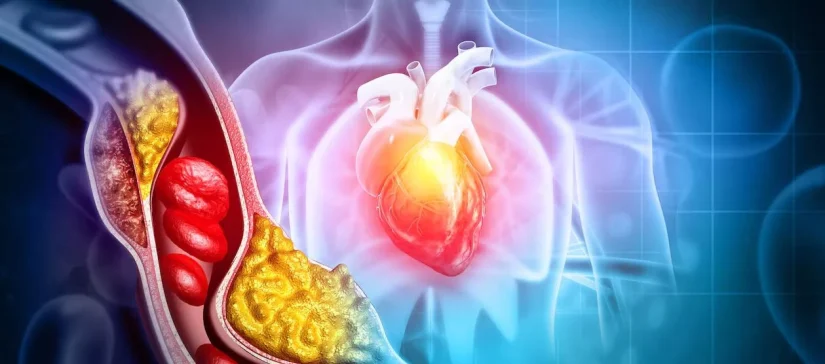 Incluye en tu dieta estos cuatro alimentos y controla tu colesterol 124 Merca2.es Todo pasa por hacerte con el control de tu propia salud