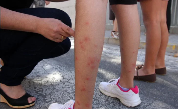 Plaga de mosquito tigre: trucos para evitar su dolorosa picadura 24 Merca2.es ninos Merca2.es