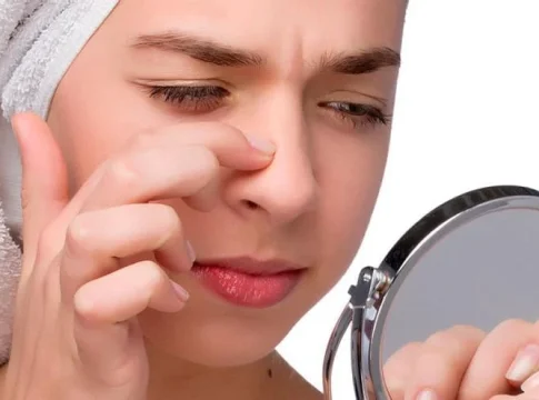 puntos-negros-mascarilla Esta es la mascarilla que promete arrancar los puntos negros de raíz