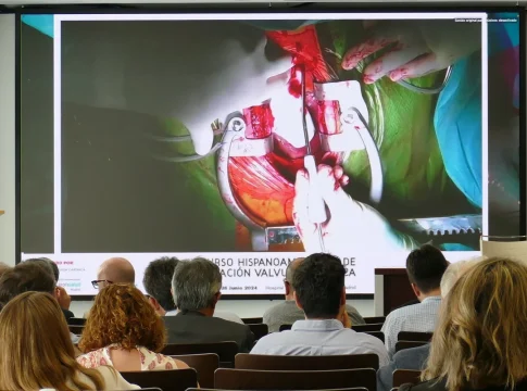 reparación válvulas En España sólo se reparan el 2% de las válvulas aórticas cuando deberían repararse más del 40%
