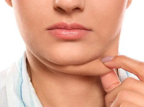 Elimina-Papada-sin-cirugía Papada fuera con el Glowup de TikTok: el truco que no necesita cirugía