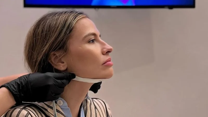 El tratamiento de 20 minutos que Mariló Montero, Marta Sánchez y Susanna Griso recomiendan para eliminar la papada 3 Merca2.es Consejos para el cuidado posterior al tratamiento de reducción de papada